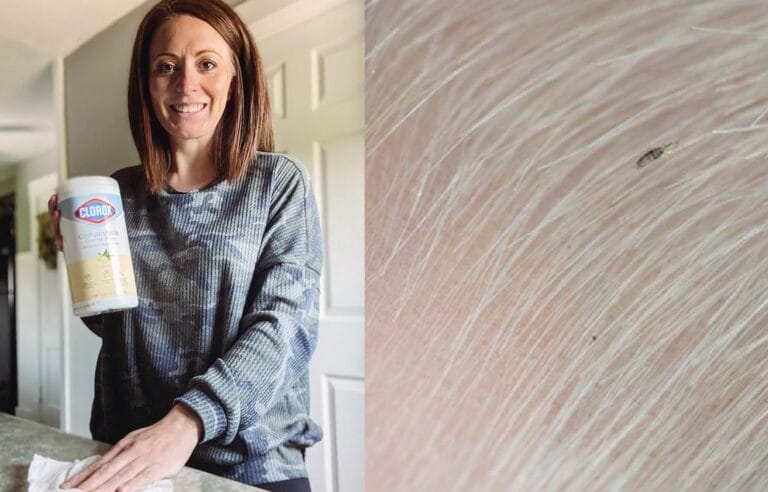 Does Clorox Kill Lice? The Shocking Truth About Bleach and Lice Eggs