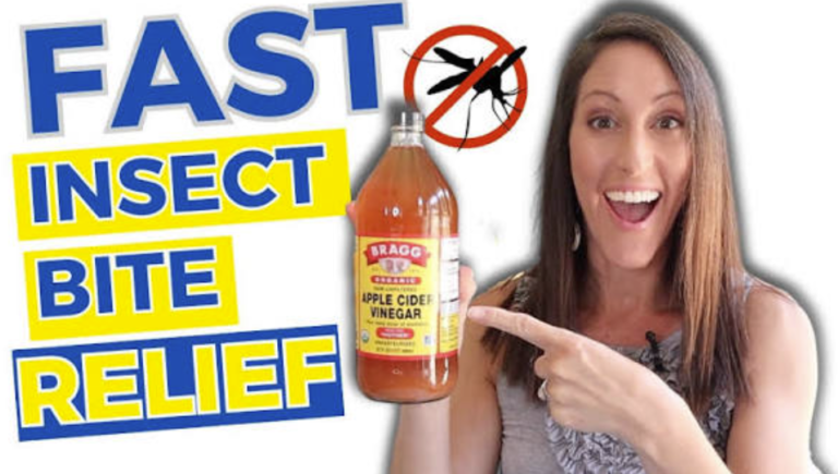 Does Apple Cider Vinegar Help with Bug Bites? A Comprehensive Analysis